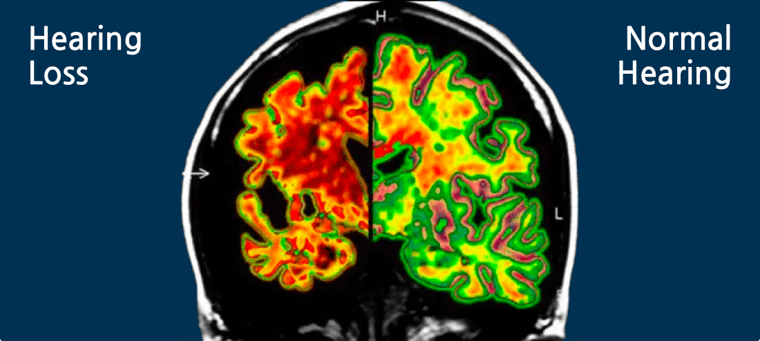 Brain Graphic